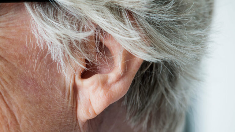 earlobe-ageing