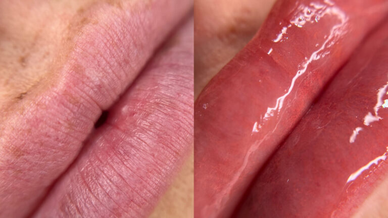 lip-blush-treatment