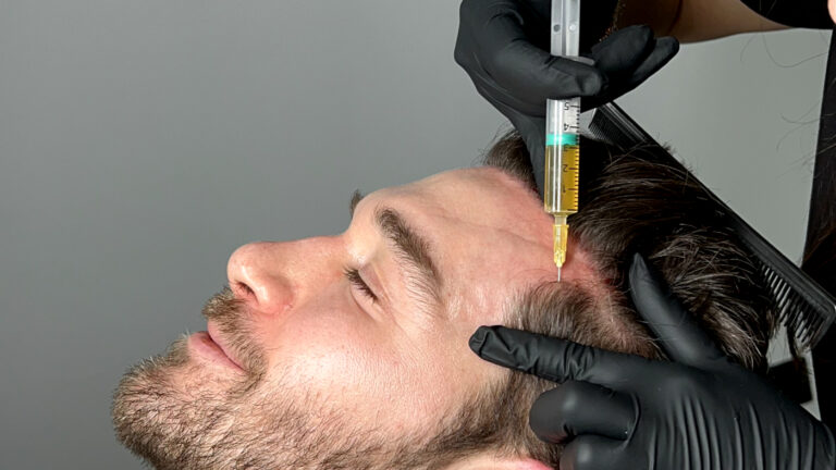 Hair PRP Treatment Available for both Men and Women at Faces By Bae