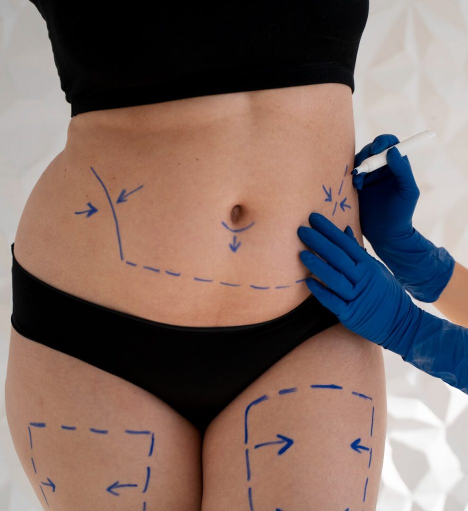 Fat Dissolving | Faces By Bae | London Aesthetics | Award Winning