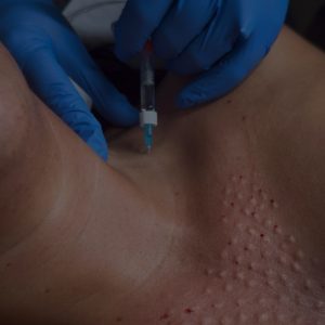 Polynucleotide | Faces By Bae | London Aesthetics | Award Winning