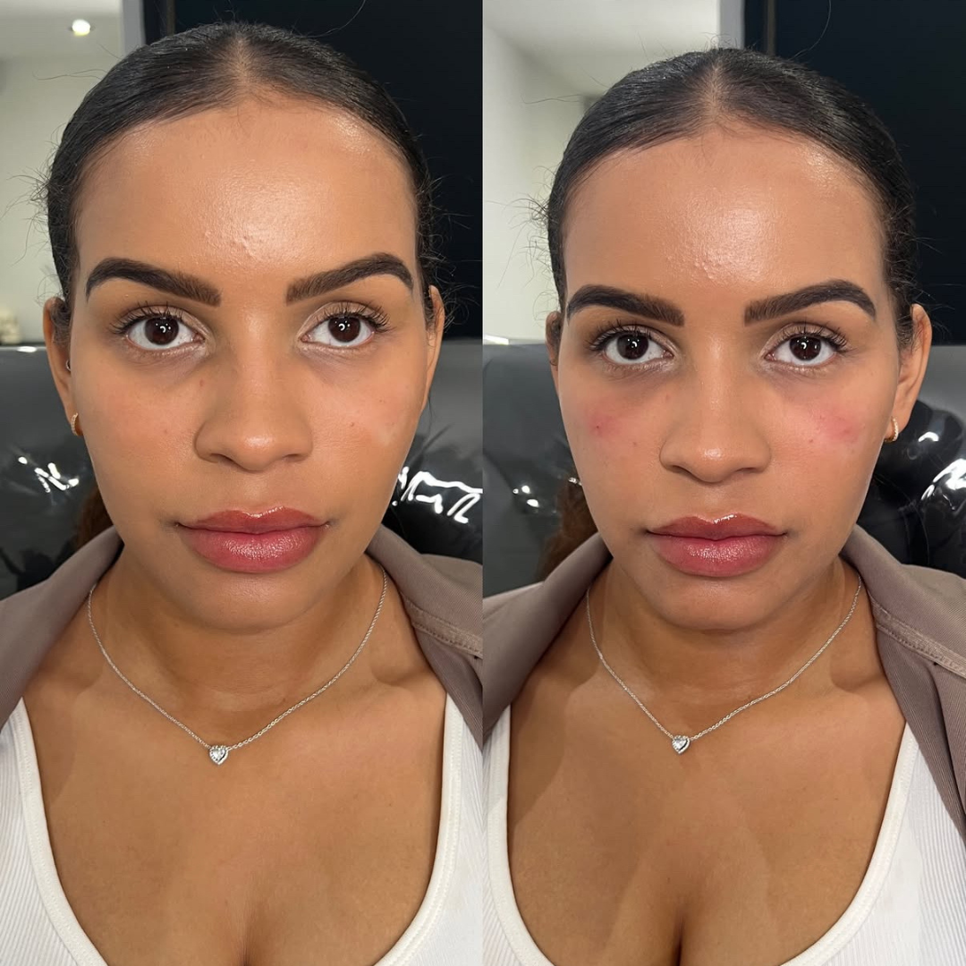 Faces By Bae | London Aesthetics | Award Winning