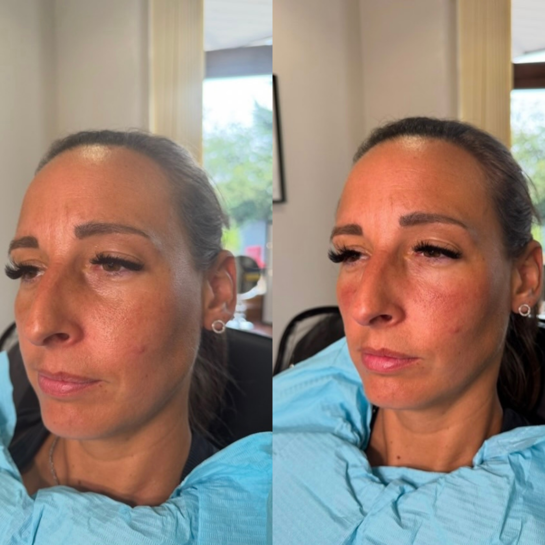 before and after skin treatment